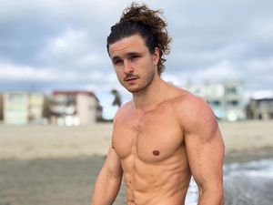 Dulu Jerawatan Sampai Bernanah, Wajah Pria Ini Mulus Setelah Stop Minum Susu