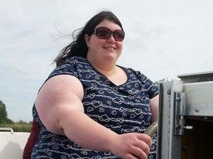 Kisah Wanita Berhasil Turunkan BB 108 Kg, Kini Malah Malu Lihat Tubuhnya