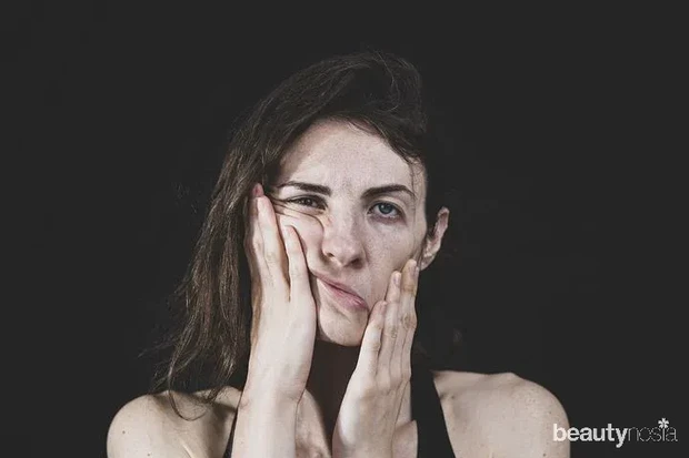 Gangguan Bipolar/Pixabay.com Gangguan bipolar juga kerap dialami oleh milenial.