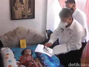 Jenguk Balita Penderita Hidrosefalus, Wabup Sumedang Berikan Bantuan