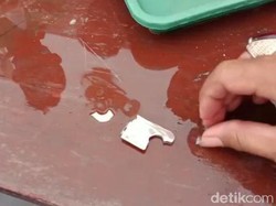 Dokter Gagal, PMK yang Akhirnya Lepas Gerendel Nyangkut di Jari Bocah Ini