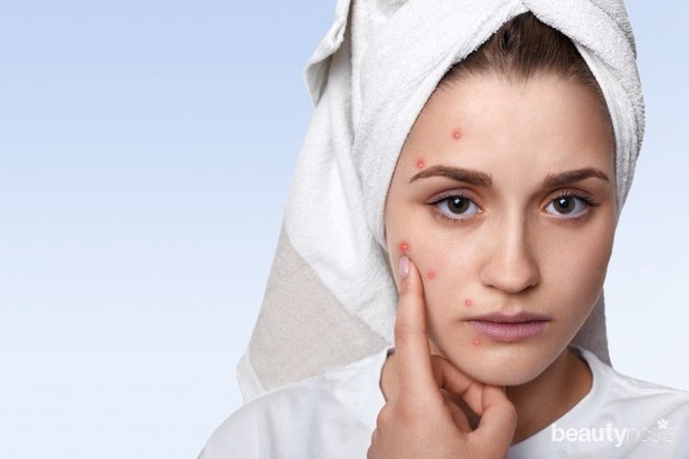 Dampak skincare ilegal