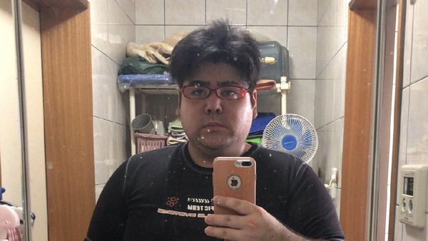 Perubahan Drastis Pria Obesitas Turun Berat Badan 69 Kg Kurang dari Setahun