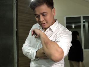 Billy Syahputra Jatuh dari Motor Trail, Amanda Manopo: Dia Emang Sombong