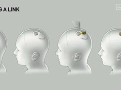 Sempat Bermasalah, Startup Chip Otak Elon Musk Cari Pasien Kedua