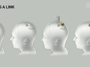 Chip yang Dipasang di Otak Manusia Sempat Bermasalah, Neuralink Klaim Tak Bahaya Chip yang Dipasang di Otak Manusia Sempat Bermasalah, Neuralink Klaim Tak Bahaya