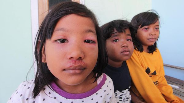 Puluhan Warga Indramayu Diserang Tomcat