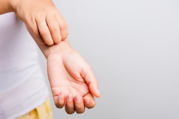 Penyebab Eksim/ Sumber: Freepik.com Stres dan gangguan emosi lainnya dapat memperburuk dermatitis atopik.