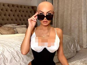 Sakit Autoimun, Bintang Reality Show Cantik Ini Gunduli Rambut