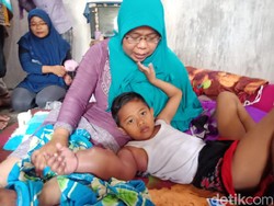 Tolong! Tangan Bocah 6 Tahun di Jombang Ini Bengkak Karena Tumor Ganas