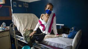 Potret Pasien Kanker di Venezuela Bertahan Hidup di Tengah Pandemi