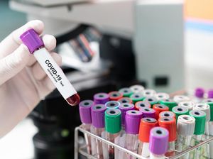 Yuk Ingat Lagi! Begini Cara Kenali dan Cegah Penularan COVID-19