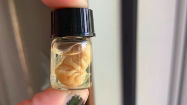 Kumpulan Barang Antik yang Bikin Gagal Paham