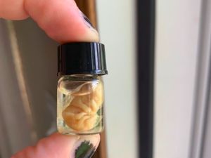 Kumpulan Barang Antik yang Bikin Gagal Paham