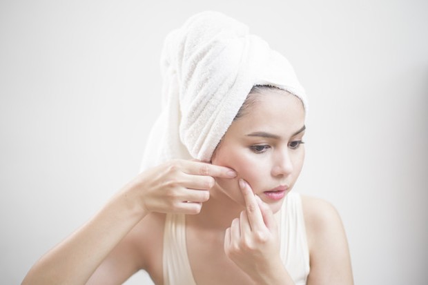 perawatan kulit berjerawat menggunakan benzoyl peroxide dengan jumlah yang tinggi punya efek samping bikin kulit iritasi