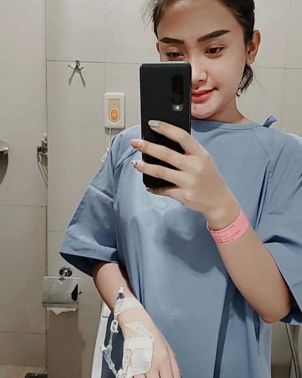 Cerita Cita Citata alergi kulit parah selama 5 tahun karena penyakit Streptococcus Tonsillitis.