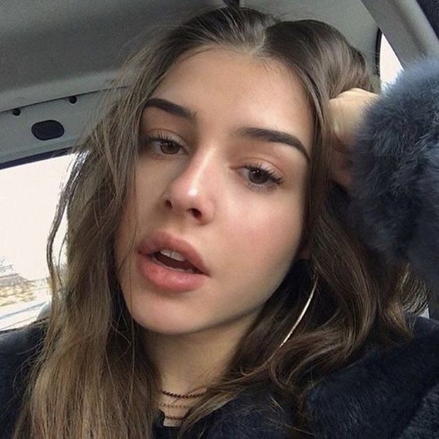 Ciri ciri purging setelah menggunaan skincare