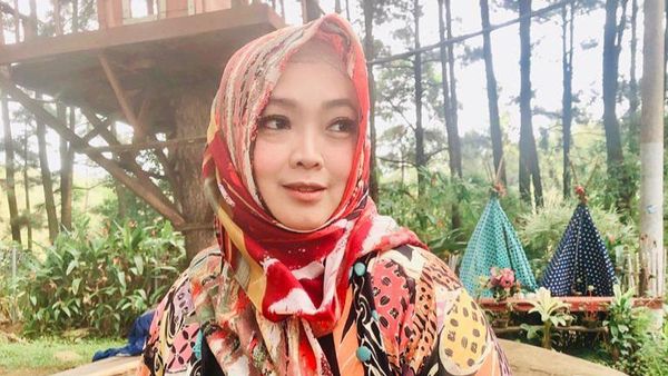 Turun 22 Kg, Rina Gunawan Bikin Pangling