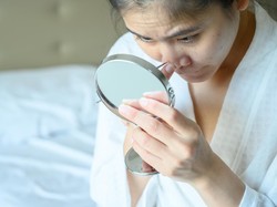 10 Cara Menghilangkan Jerawat Dengan Mudah, Cepat, dan Tanpa Obat