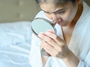 10 Cara Menghilangkan Jerawat Dengan Mudah, Cepat, dan Tanpa Obat 10 Cara Menghilangkan Jerawat Dengan Mudah, Cepat, dan Tanpa Obat