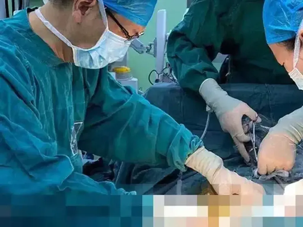 Iseng Masukkan Gelas Bir ke Bokong, Pria Ini Harus Dioperasi Iseng Masukkan Gelas Bir ke Bokong, Pria Ini Harus Dioperasi