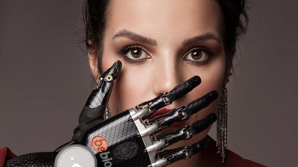 Potret Wanita yang Tangannya Dipotong Mantan Suami, Kini Pakai Tangan Palsu