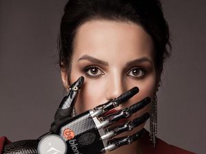 Potret Wanita yang Tangannya Dipotong Mantan Suami, Kini Pakai Tangan Palsu