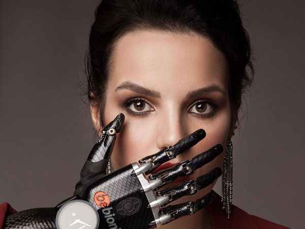 Potret Wanita yang Tangannya Dipotong Mantan Suami, Kini Pakai Tangan Palsu