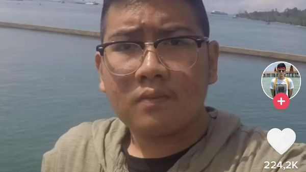 Foto Pria Dulu Gemuk & Jerawatan, Kini Bikin Pangling Setelah Disakiti Mantan