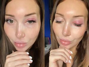 Extension Bulu Mata Gagal, Mata Model Ini Bengkak Hingga Harus Berobat ke RS