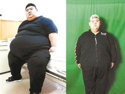 Hanya Dalam Waktu 6 Bulan, Pria Tergemuk di China Ini Berhasil Turun 142 Kg