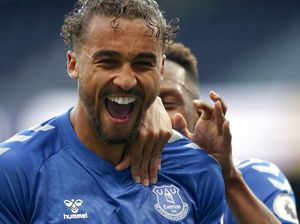 Awas Kepala Dominic Calvert-Lewin!