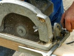 Gergaji Tangannya, Perempuan Ini Dinyatakan Bersalah Atas Penipuan Asuransi