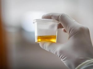 Kateter Urine: Fungsi dan Jenis-jenisnya