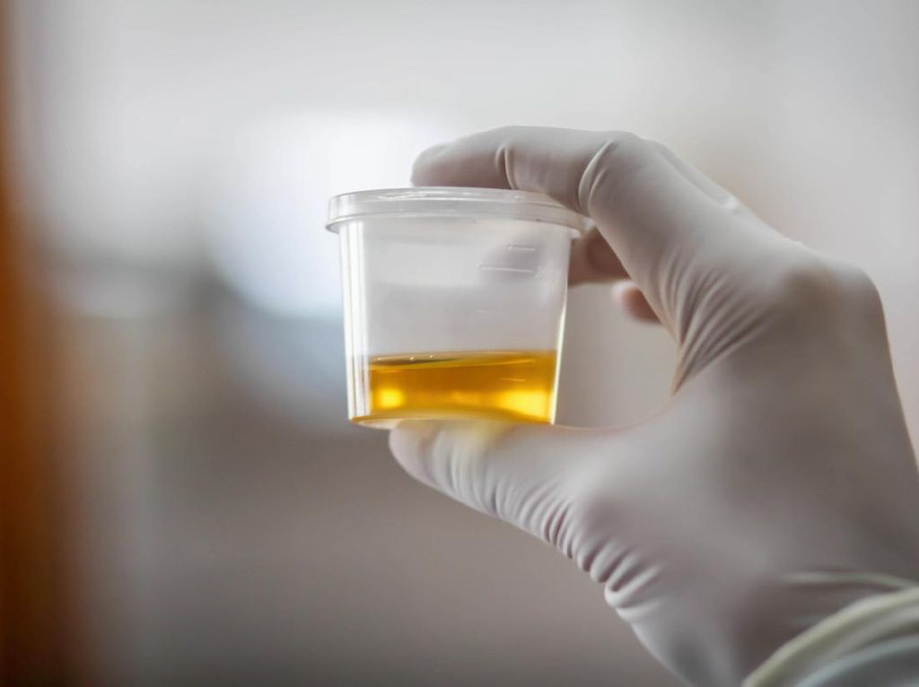 Kateter Urine: Fungsi dan Jenis-jenisnya Kateter Urine: Fungsi dan Jenis-jenisnya