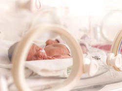 Kisah Bayi Prematur Pertama yang Dirawat di Inkubator, Berbobot Cuma 1,3 Kg