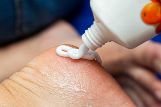 Perawatan Kulit Kaki/ Sumber: Freepik.com Madu dapat bekerja sebagai obat alami untuk tumit pecah-pecah. Perlu diketahui, madu memiliki sifat antimikroba dan antibakteri.