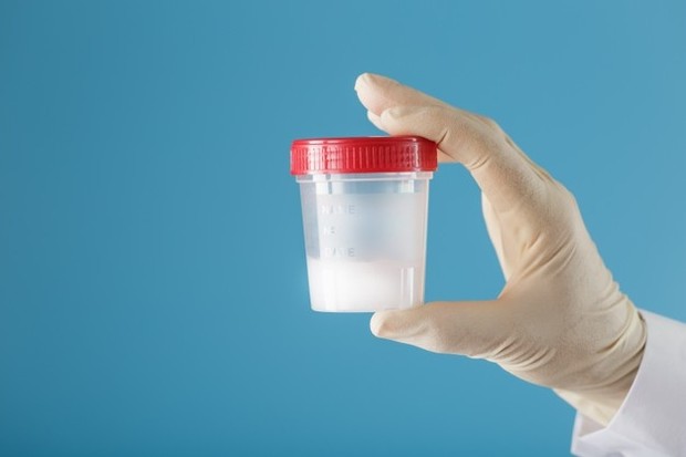 Jika kamu memilih untuk mendapatkan sampel sperma di rumah, kamu akan diinstruksikan tentang cara menyimpan sampel sperma dengan tepat hingga kamu dapat membawanya ke lab dalam waktu satu jam tanpa ada kurang satu apapun.