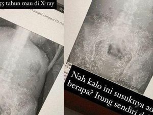 Ini Alasan Artis Pakai Susuk Ini Alasan Artis Pakai Susuk
