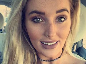 Transformasi Wanita yang Terobsesi Oplas, Dulu Imut Kini Ingin Tampil Palsu