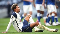 Pertama adalah Dele Alli. Gelandang serang ini memang sulit masuk ke dalam skuad utama (Getty Images/Alex Pantling)