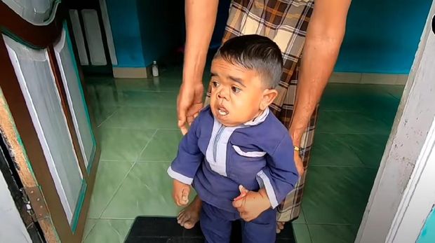 Muzakir, Pria 21 Tahun Terjebak dalam Tubuh Bayi