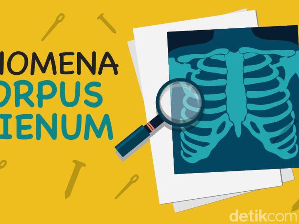 Bagaimana Dokter Menjelaskan Santet dan Susuk? Bagaimana Dokter Menjelaskan Santet dan Susuk?