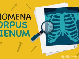 Bagaimana Dokter Menjelaskan Santet dan Susuk? Bagaimana Dokter Menjelaskan Santet dan Susuk?