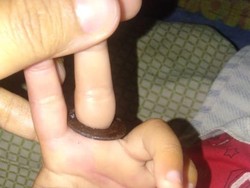 Kisah Damkar Saat Bantu Lepaskan Ring Besi dari Jemari Balita