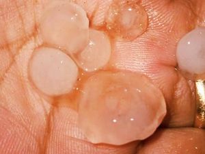 Hujan Es Terjang Kota-Kabupaten Bogor, Ini Penjelasan BMKG