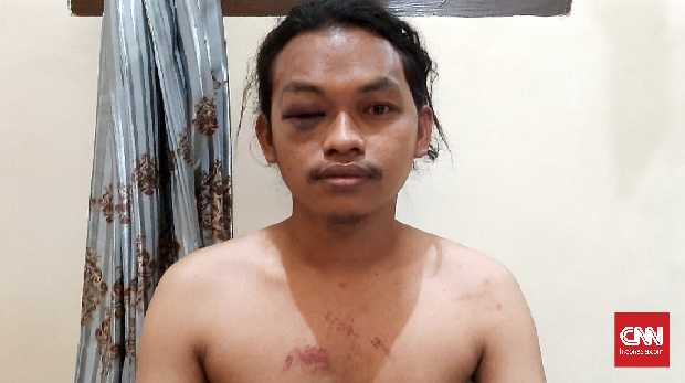 Dua buruh bangunan di Kendari, La Duma (29) dan La Iwan (29) jadi korban salah sasaran  polisi saat demo ricuh di sekitar Mapolda Sultra, Sabtu (26/9).