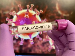 COVID-19 Diprediksi Bakal Jadi Endemik Seperti Flu