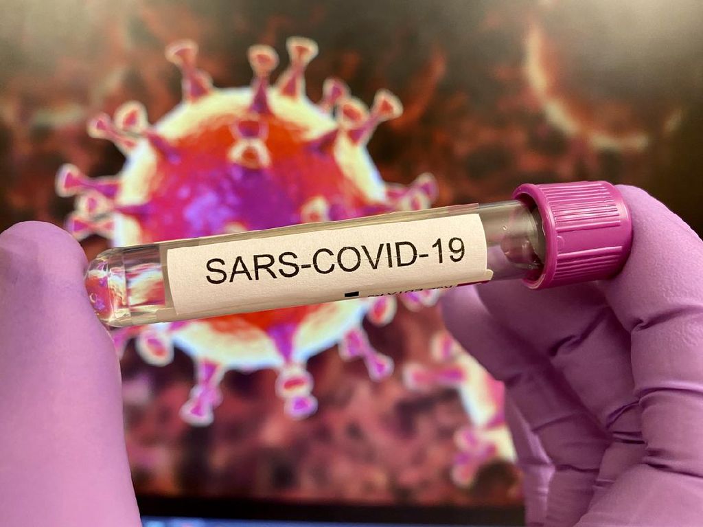 Dinkes: Virus D614G Mutasi Corona Sudah Terdeteksi di Kalbar Sejak Agustus