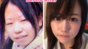 Potret Wanita Jepang yang Transformasi Oplasnya Bikin Netizen Kaget